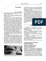 American Journal of Ophthalmology Volume 102 Issue 4 1986 (Doi 10.1016 - 0002-9394 (86) 90094-2) Sachs, David Levin, Peter S. Dooley, Kevin - Marginal Eyelid Laceration at Birth