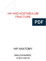 Acetabular and Hip Fracture