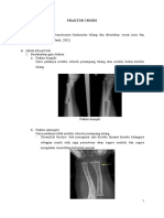 Fraktur Cruris