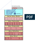 Dasar Pertama Baca EKG I