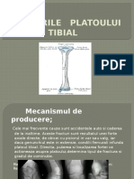 Platou Tibial-Fr Diaf Oase Gamba, GR 33