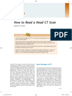How to read ct scan