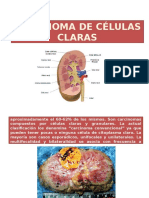 Carcinoma de Células Claras