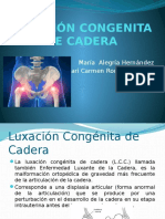 Luxación Congenita de Cadera