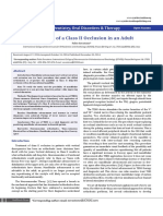 Correction of A Class II Occlusion in An Adult