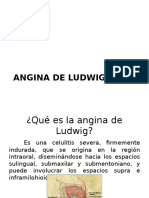 Angina de Ludwig