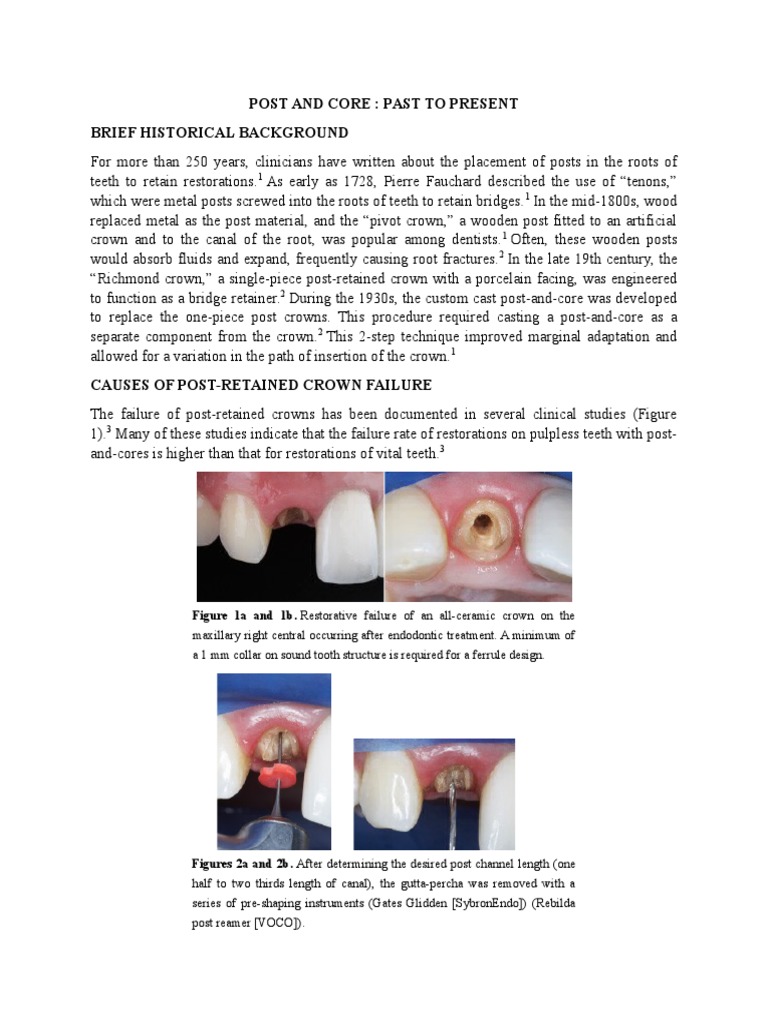 Post and Core PDF Dentistry Branches Dentistry
