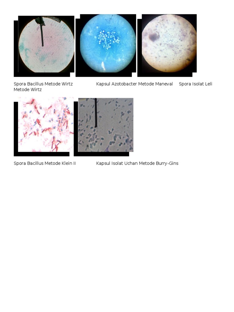 Pewarnaan Spora Dan Kapsul