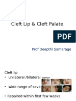 Cleft Lip & Cleft Palate