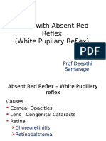 Absent Red Reflex