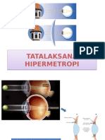 Tatalaksana Hipermetropi