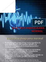 Electrocardiogram A