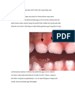 Early Childhood Caries