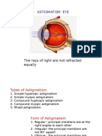Types of Astigmatism and Treatment Options