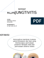 Konjungtivitis