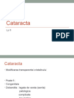 Cataracta