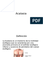 Acalasia