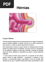 Hérrnias