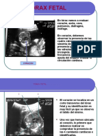 TECNICAS ECOGRÁFICAS PARA REVISIÓN DEL Tórax Fetal DRA. DIMARE