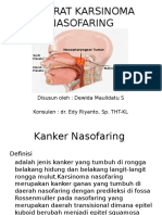 Referat Karsinoma Nasofaring