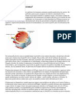 ¿Qué Es El Glaucoma?