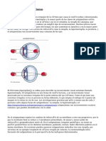 Miopía Y Astigmatismo