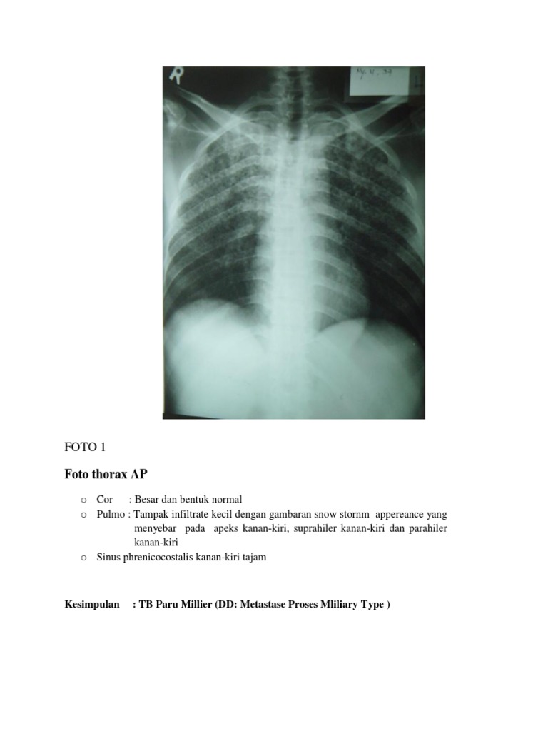Analisis Foto Rontgen Thorax dan Kesimpulan | PDF