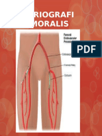Arteriografi Femoralis
