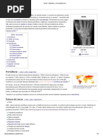 Artrite – Wikipédia, A Enciclopédia Livre