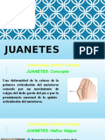 Juanetes.pptx