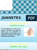 Juanetes