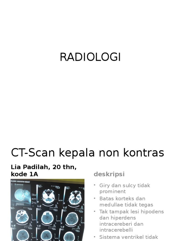 RADIOLOGI | PDF