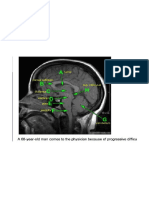 Neuro Images Step1