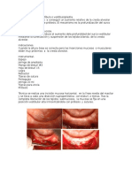 Profundización de Vestíbulo o Vestibuloplastia