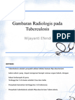 Tuberkulosis ppt