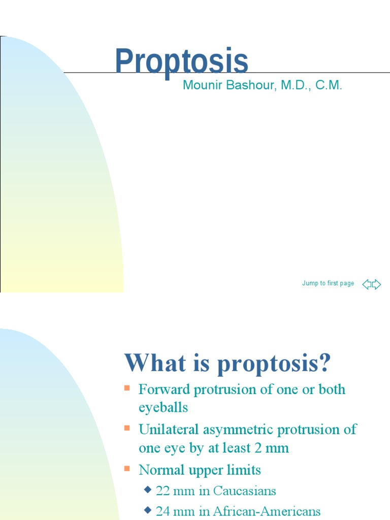 Proptosis | PDF