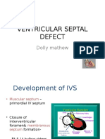 Ventricular Septal Defect