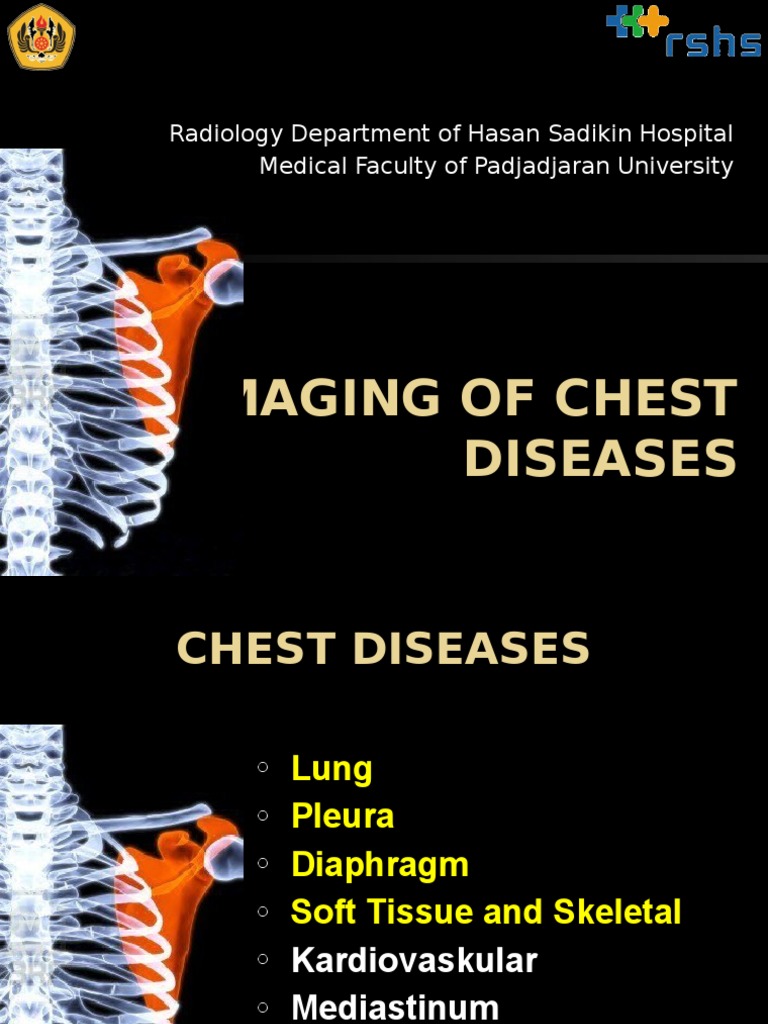 Imaging of Chest Diseases Lung Pneumonia Free 30day Trial Scribd