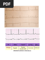 Poze Ekg 3