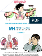 How Asthma Attacks & What Causes Asthma