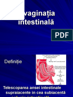 Invaginatie de Intestin