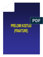 Frakture Kostiju