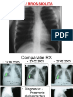 Poze Respirator