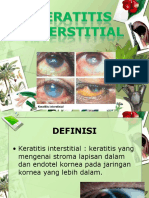 Keratitis Interstitial