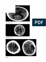 TokSoPlasmOsis