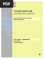 Download Pengolahan Citra Payudara Dengan MatLab by Siti Julaiha Grbner SN29704037 doc pdf