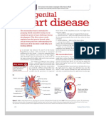 Congenital Heart Disease