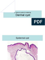 DR Sarma's Guide To Mastering Dermal Cyst.