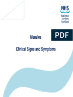 Measles Clinical Signs Symptoms