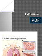 Pneumonia: BY: Deny Budiman Melinda Sari M. Ilhamul Karim